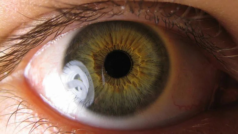 eye image